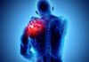 Assessment of neck and back pain in the patient