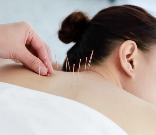 Diabetes al estrés: Beneficios de la acupuntura más allá del dolor corporal
