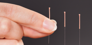 acupuncture Beverly Hills