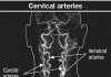 Dolor de cuello severo: ¿una señal de algo serio?

