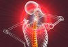 Do’s, don’ts and dosing for low-level laser therapy to help reduce inflammation and speed healing when treating arthritis and neck pain