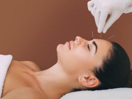  ¿Cuáles son los beneficios para la salud de la acupuntura?  - Newz Gancho |  Noticias sobre discapacidad
