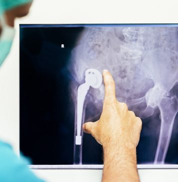 Por qué viene y cómo aliviar el dolor de cadera Por qué viene y cómo aliviar el dolor de cadera