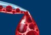Magrolimab más rituximab/quimio provoca respuestas profundas en DLBCL en recaída/refractario
