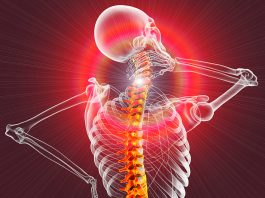 Do’s, don’ts and dosing for low-level laser therapy to help reduce inflammation and speed healing when treating arthritis and neck pain