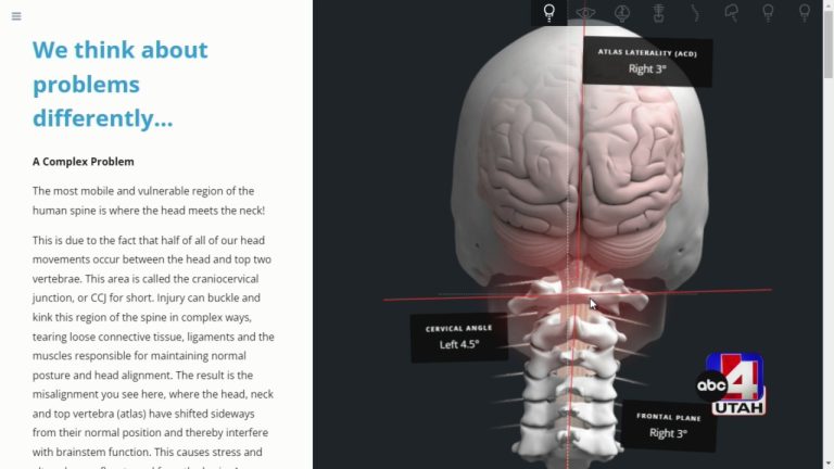 How this medical breakthrough can ease neck and head pain ABC4.com