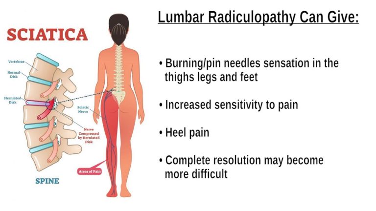 can sciatic nerve cause plantar fasciitis