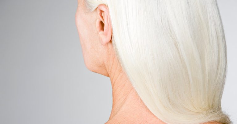 Do neck and face skins age more quickly? What do experts say? The New York Times